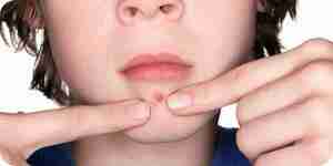Pop a Pimple