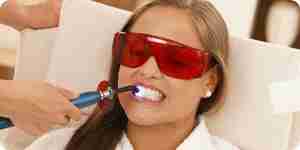 Whiten teeth: whitening methods and treatments