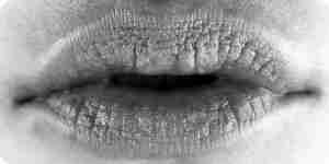 Dry lips Dry lips