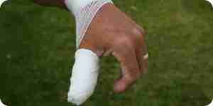 Treatment of burns